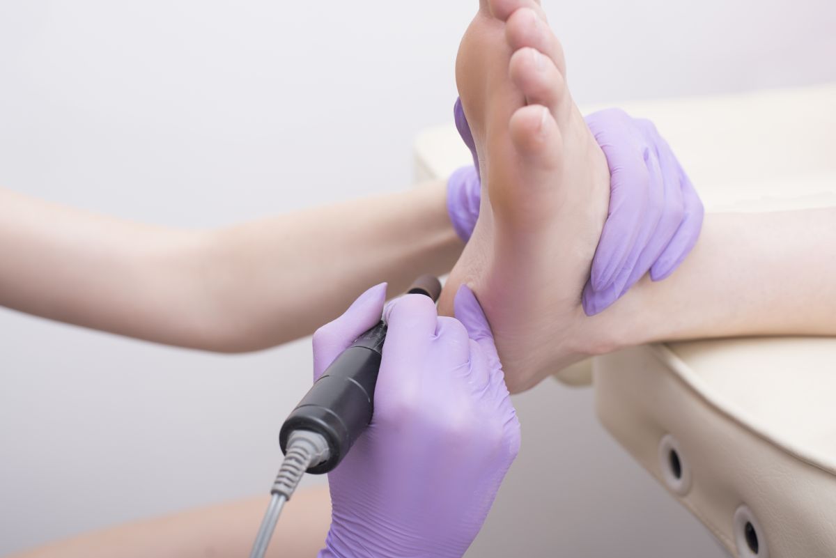 Skóra stóp po zabiegu podologicznym — zalecenia na 7 dni