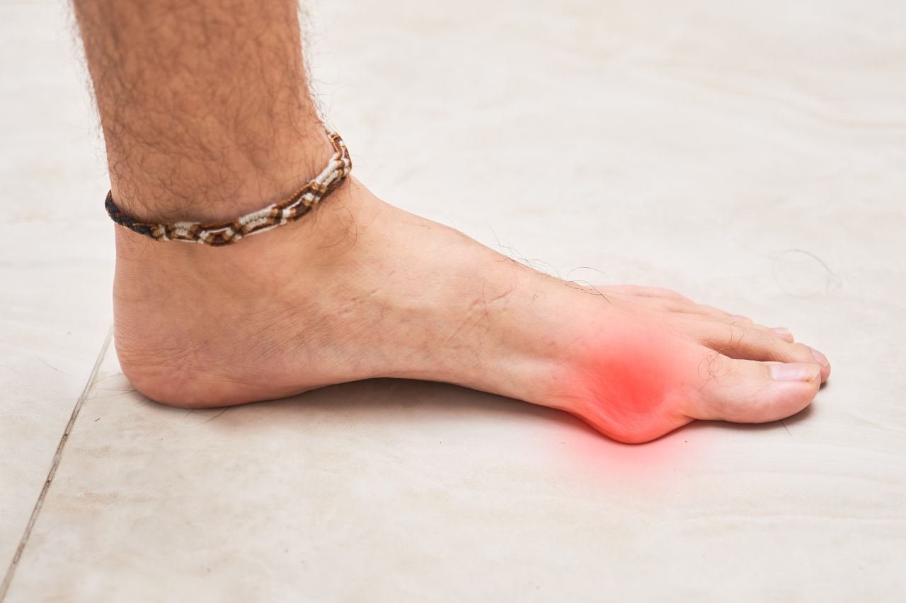 Hallux rigidus (sztywny paluch) – jak odróżnić od haluksa?